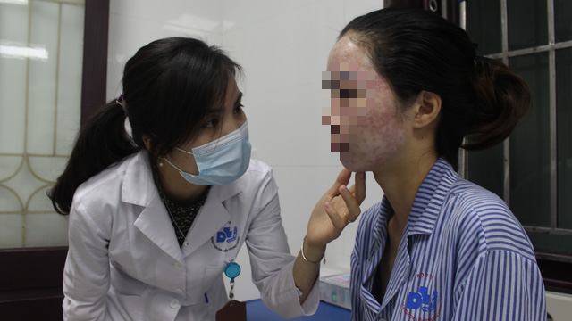 Bác sĩ thăm khám cho bệnh nhân bị tổn thương toàn bộ vùng mặt sau khi điều trị mụn, nám ở spa